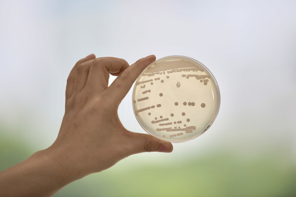 The key factor for doing better seed culture in fermentation industry